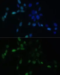 Anti-SMAD9 antibody used in Immunocytochemistry/ Immunofluorescence (ICC/IF). GTX64515