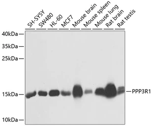 Anti-Calcineurin B antibody used in Western Blot (WB). GTX64517
