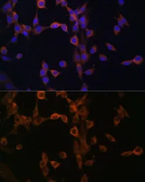 Anti-Calcineurin B antibody used in Immunocytochemistry/ Immunofluorescence (ICC/IF). GTX64517