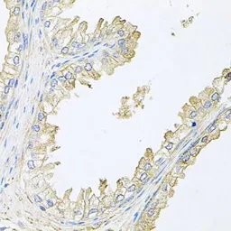 Anti-Calcineurin B antibody used in IHC (Paraffin sections) (IHC-P). GTX64517