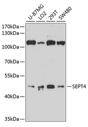 Anti-ARTS antibody used in Western Blot (WB). GTX64518