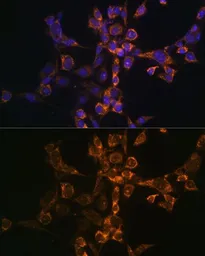Anti-ARTS antibody used in Immunocytochemistry/ Immunofluorescence (ICC/IF). GTX64518