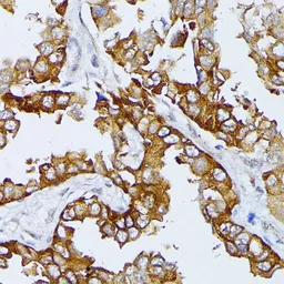 Anti-ARTS antibody used in IHC (Paraffin sections) (IHC-P). GTX64518