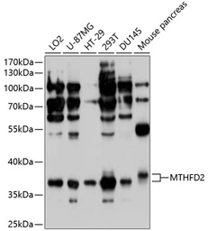 Anti-MTHFD2 antibody used in Western Blot (WB). GTX64519