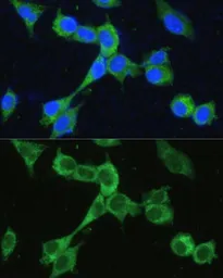 Anti-MTHFD2 antibody used in Immunocytochemistry/ Immunofluorescence (ICC/IF). GTX64519