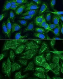 Anti-MTHFD2 antibody used in Immunocytochemistry/ Immunofluorescence (ICC/IF). GTX64519