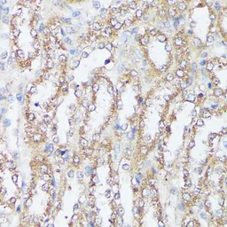 Anti-MTHFD2 antibody used in IHC (Paraffin sections) (IHC-P). GTX64519