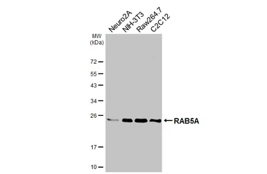 Anti-RAB5A antibody [GT318] used in Western Blot (WB). GTX645193