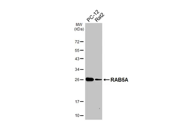 Anti-RAB5A antibody [GT318] used in Western Blot (WB). GTX645193