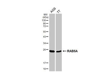 Anti-RAB5A antibody [GT318] used in Western Blot (WB). GTX645193