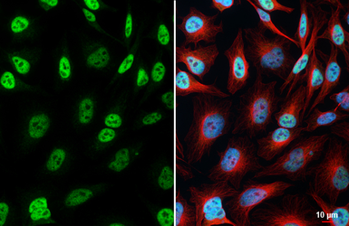 Anti-MLH1 antibody [HL5028] used in Immunocytochemistry/ Immunofluorescence (ICC/IF). GTX645198