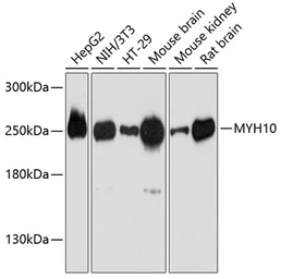 Anti-MYH10 antibody used in Western Blot (WB). GTX64520