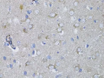 Anti-MYH10 antibody used in IHC (Paraffin sections) (IHC-P). GTX64520