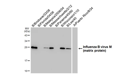 Anti-Influenza B virus M (matrix protein) antibody [HL5032] used in Western Blot (WB). GTX645202