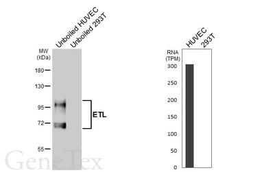 Anti-ETL antibody [HL5037] used in Western Blot (WB). GTX645207