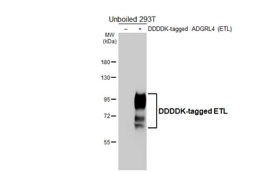 Anti-ETL antibody [HL5037] used in Western Blot (WB). GTX645207
