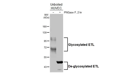 Anti-ETL antibody [HL5037] used in Western Blot (WB). GTX645207