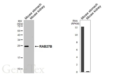 Anti-RAB27B antibody [HL5044] used in Western Blot (WB). GTX645214