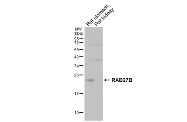 Anti-RAB27B antibody [HL5044] used in Western Blot (WB). GTX645214