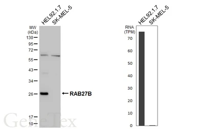 Anti-RAB27B antibody [HL5044] used in Western Blot (WB). GTX645214