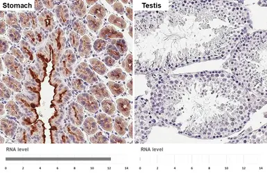 Anti-RAB27B antibody [HL5044] used in IHC (Paraffin sections) (IHC-P). GTX645214