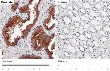 Anti-RAB27B antibody [HL5044] used in IHC (Paraffin sections) (IHC-P). GTX645214