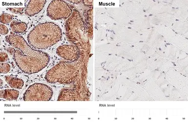 Anti-RAB27B antibody [HL5044] used in IHC (Paraffin sections) (IHC-P). GTX645214