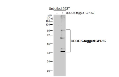 Anti-GPR62 antibody [HL5046] used in Western Blot (WB). GTX645216