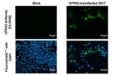 Anti-GPR62 antibody [HL5046] used in Immunocytochemistry/ Immunofluorescence (ICC/IF). GTX645216