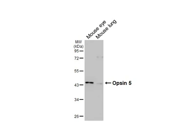 Anti-Opsin 5 antibody [HL5048] used in Western Blot (WB). GTX645218