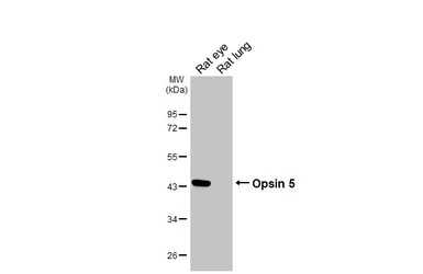 Anti-Opsin 5 antibody [HL5048] used in Western Blot (WB). GTX645218