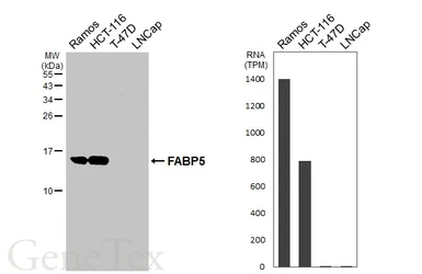 Anti-FABP5 antibody [HL5052] used in Western Blot (WB). GTX645222