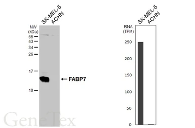 Anti-FABP7 antibody [HL5054] used in Western Blot (WB). GTX645224