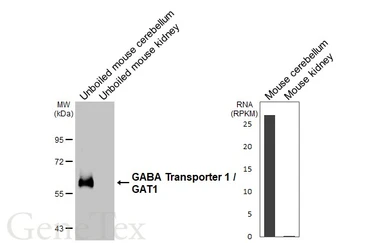 Anti-GABA Transporter 1 / GAT1 antibody [HL3475-MS] used in Western Blot (WB). GTX645234