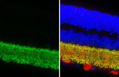 Anti-GABA Transporter 1 / GAT1 antibody [HL3475-MS] used in IHC (Paraffin sections) (IHC-P). GTX645234