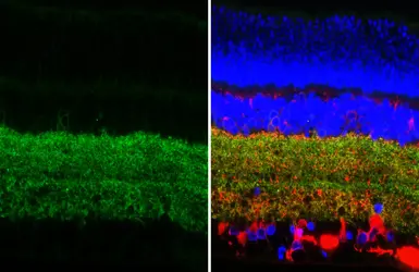 Anti-GABA Transporter 1 / GAT1 antibody [HL3475-MS] used in IHC (Paraffin sections) (IHC-P). GTX645234