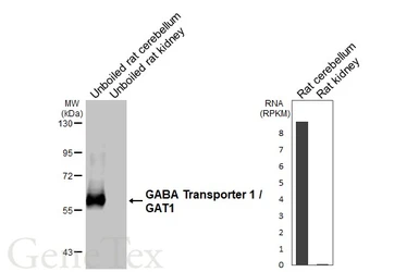 Anti-GABA Transporter 1 / GAT1 antibody [HL3475-MS] used in Western Blot (WB). GTX645234