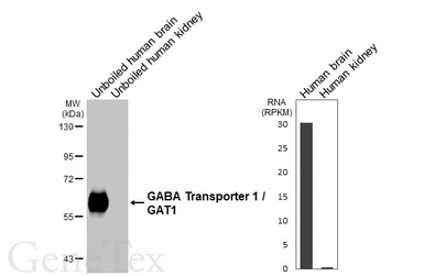 Anti-GABA Transporter 1 / GAT1 antibody [HL3475-MS] used in Western Blot (WB). GTX645234