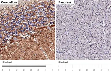 Anti-GABA Transporter 1 / GAT1 antibody [HL3475-MS] used in IHC (Paraffin sections) (IHC-P). GTX645234