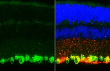 Anti-RBPMS antibody [HL3090-RT] used in IHC (Paraffin sections) (IHC-P). GTX645235