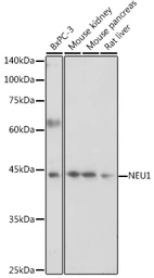 Anti-NEU1 antibody used in Western Blot (WB). GTX64524