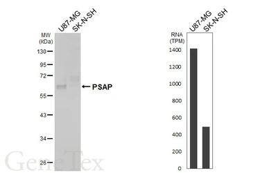 Anti-PSAP antibody [HL5063] used in Western Blot (WB). GTX645253