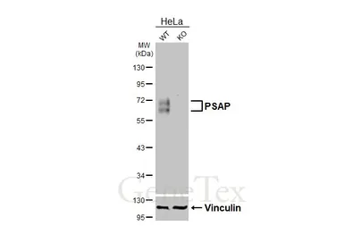 Anti-PSAP antibody [HL5063] used in Western Blot (WB). GTX645253