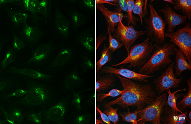 Anti-PSAP antibody [HL5063] used in Immunocytochemistry/ Immunofluorescence (ICC/IF). GTX645253