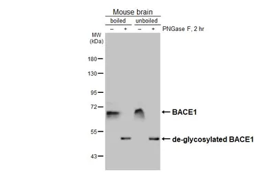 Anti-BACE1 antibody [HL5066] used in Western Blot (WB). GTX645256