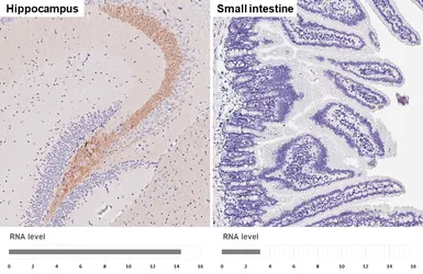 Anti-BACE1 antibody [HL5066] used in IHC (Paraffin sections) (IHC-P). GTX645256