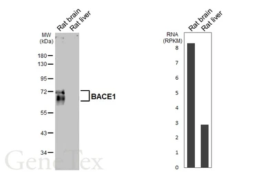 Anti-BACE1 antibody [HL5066] used in Western Blot (WB). GTX645256