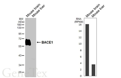 Anti-BACE1 antibody [HL5067] used in Western Blot (WB). GTX645257