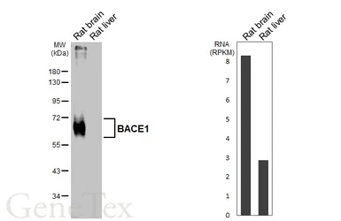 Anti-BACE1 antibody [HL5067] used in Western Blot (WB). GTX645257