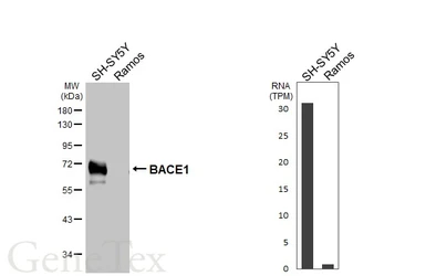 Anti-BACE1 antibody [HL5067] used in Western Blot (WB). GTX645257